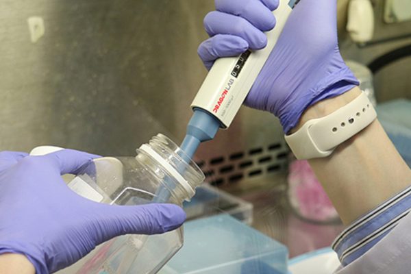 ALS Hastalığında Umut Veren Gelişme: Genetik Temelli Yeni Tedavi Yöntemi Üzerinde Çalışılıyor